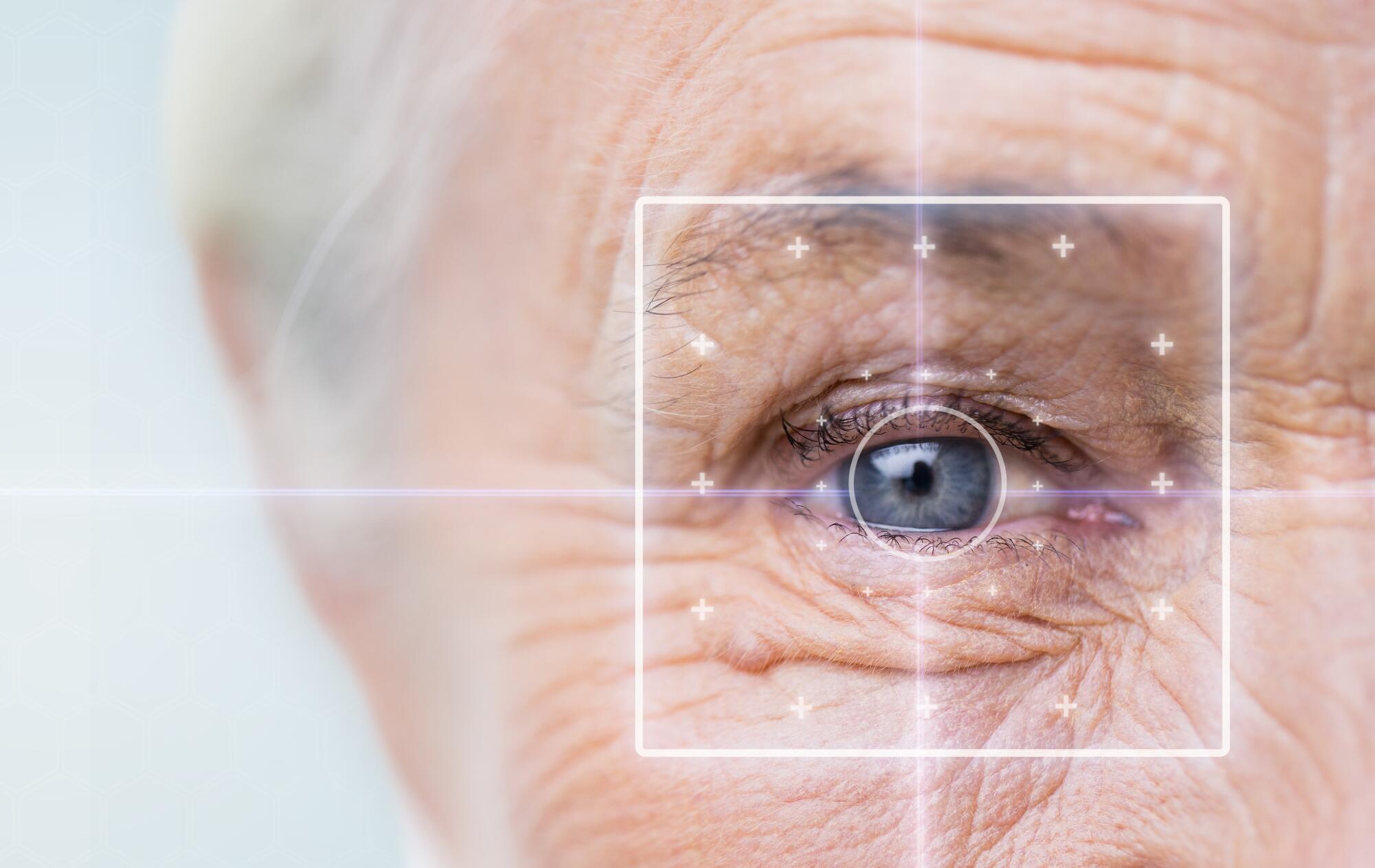 Glaucoma vs Cataracts: What Seniors and Families Should Know